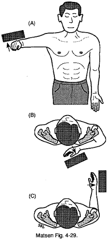 Figure 4 - Positive tendon sign