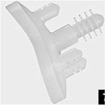 FIGURE 2: Glenoid component that is used for Total Shoulder Arthroplasty only. It is made of a plastic known as polyethylene.