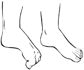 Figure 12 - Toe curl