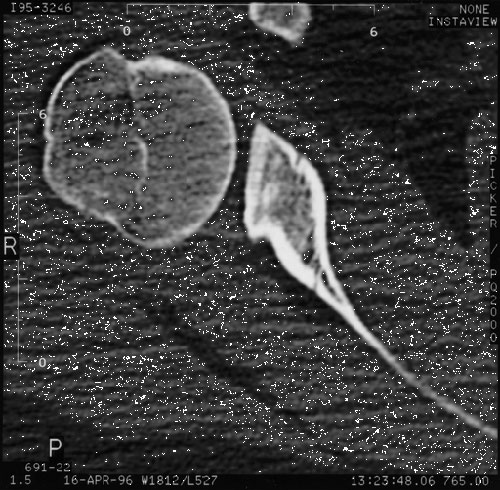Figure 23
