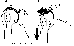 Figure 33