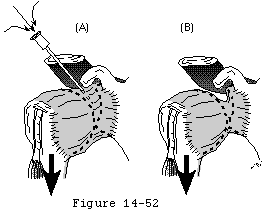 Figure 38
