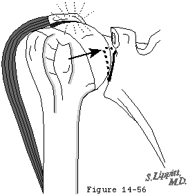 Figure 42