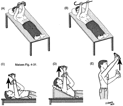 Figure 3 - Progressive supine press