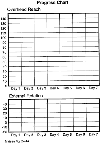 Figure 11 - Progress chart