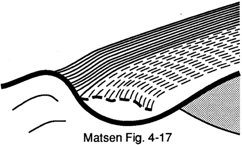 Figure 5 - Creeping tears