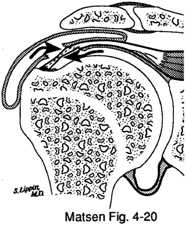 Figure 8 - Articular and bursal sides
