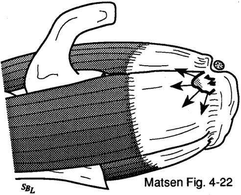 Figure 10 - Additional fiber failure