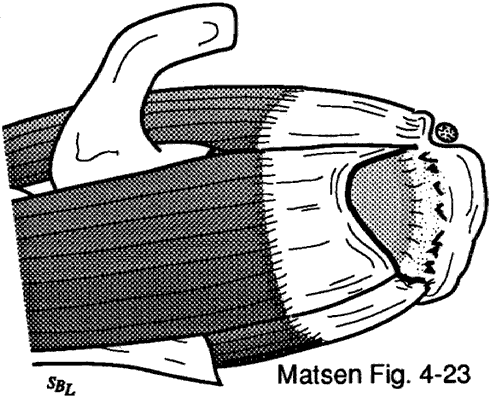Figure 11 - Infraspinatus and teres minor
