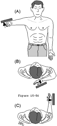 Figure 21