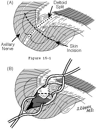 Figure 21