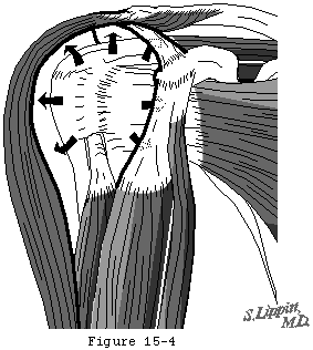 Figure 24