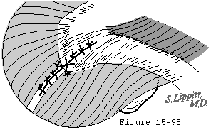Figure 26