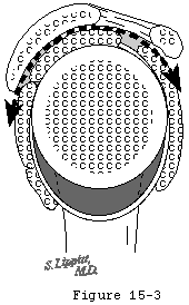Figure 30