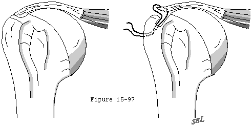 Figure 41