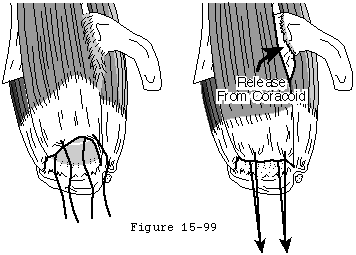 Figure 43
