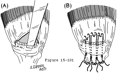 Figure 62