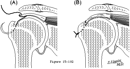 Figure 63