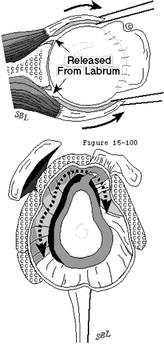 Figure 52