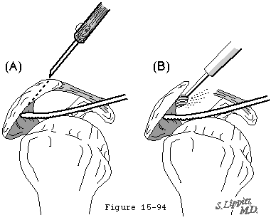 Figure 57
