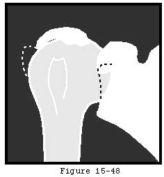 Figure 77
