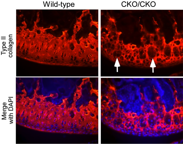 Epigenetic regulation of articular joints