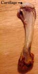 Hip Arthritis - Example of cartilage