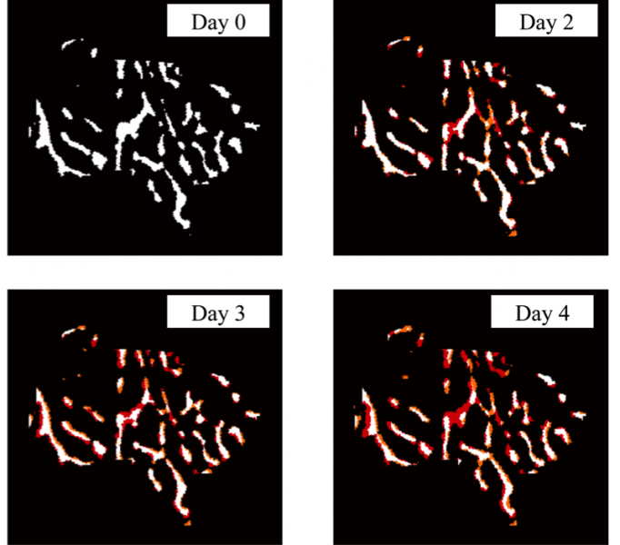 Bone loss initiation in the Trabecular Compartment of the Tibia