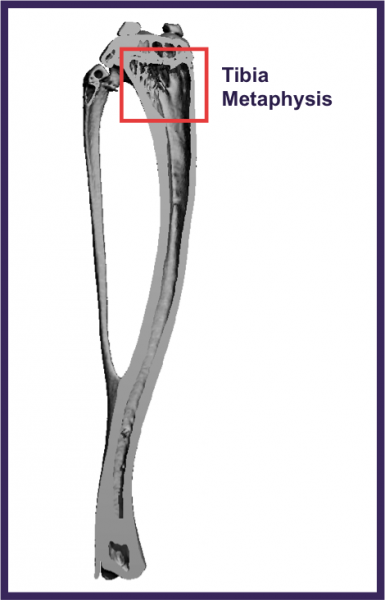 Tibia Metaphysis Scanning Location