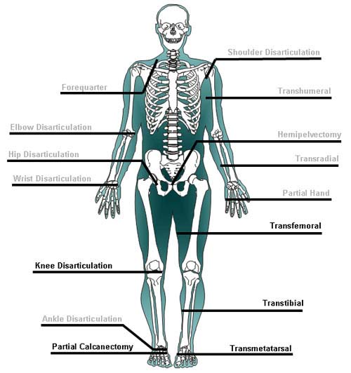 Amputation Levels