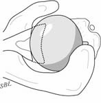 Reverse Total Shoulder