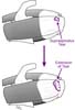 Supraspinatus tear of the rotator cuff