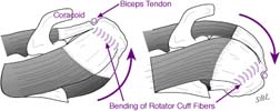 Rotator cuff viewed from above