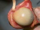 Normal rotator cuff
attachment around
the humeral head