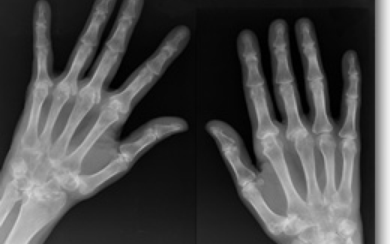 translational research for upper extremity lab image