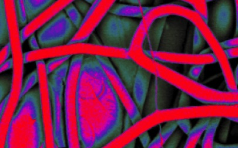 Tissue and Regenerative Engineering (TARE) Lab