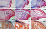 Human Digit Regeneration