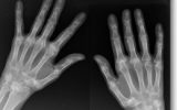 translational research for upper extremity lab image